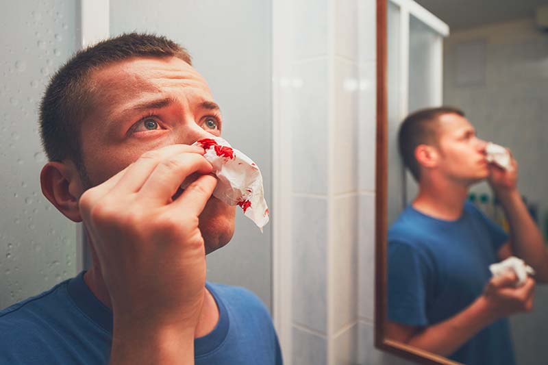 Männliche Gewalt: Ein Mann hält sich ein blutiges Taschentuch unter die Nase